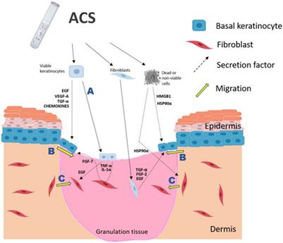 A novel method for the establishment of autologous skin cell suspensions: characterisation of cellular sub-populations, epidermal stem cell content and wound response-enhancing biological properties
